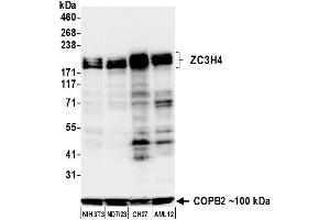 Western Blotting (WB) image for anti-Zinc Finger CCCH-Type Containing 4 (ZC3H4) (AA 1050-1100) antibody (ABIN7795760)