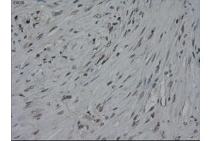 Immunohistochemical staining of paraffin-embedded colon using anti-IL-3 (ABIN2452543) mouse monoclonal antibody. (IL-3 抗体  (AA 20-152))