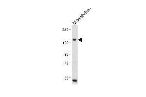 Anti-c-KIT Antibody (N-term) at 1:1000 dilution+ Mouse cerebellum tissue lysate Lysates/proteins at 20 μg per lane. (KIT 抗体  (N-Term))