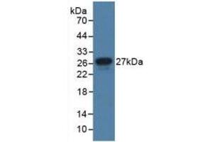 Western blot analysis of recombinant Human JAM1. (F11R 抗体  (AA 64-249))