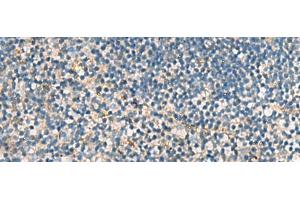 Immunohistochemistry of paraffin-embedded Human tonsil tissue using ACTC1 Polyclonal Antibody at dilution of 1:55(x200) (ACTC1 抗体)