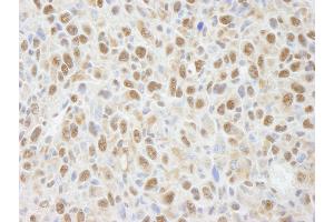 anti-Protein Phosphatase 4, Catalytic Subunit (PPP4C) (AA 1-50) antibody