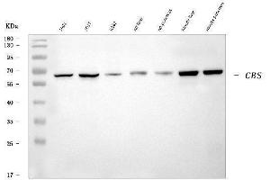 Western blot analysis of CBS using anti-CBS antibody (ABIN7599636).