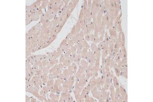 Immunohistochemistry of paraffin-embedded rat heart using PRPF31 antibody (ABIN6132996, ABIN6146262, ABIN6146264 and ABIN6221399) at dilution of 1:100 (40x lens). (PRPF31 抗体  (AA 1-200))