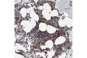 Immunohistochemical staining of human bone marrow with FCER1G polyclonal antibody  shows strong cytoplasmic positivity in bone marrow poietic cells. (FCER1G 抗体)
