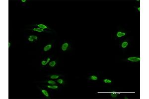 Immunofluorescence of purified MaxPab antibody to TDP1 on HeLa cell.