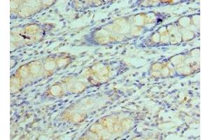 Immunohistochemistry of paraffin-embedded human colon tissue using ABIN7154290 at dilution of 1:100 (GOLM1 抗体  (AA 112-401))