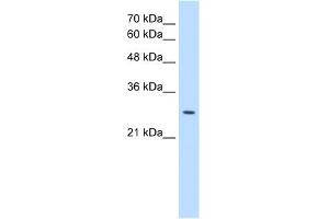 WB Suggested Anti-EBP Antibody Titration:  0. (EBP 抗体  (N-Term))