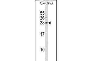 ARL1 Antibody (Center) (ABIN1538637 and ABIN2848485) western blot analysis in SK-BR-3 cell line lysates (35 μg/lane). (ARL1 抗体  (AA 81-108))