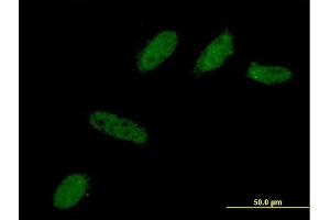 Immunofluorescence of monoclonal antibody to BCL2L12 on HeLa cell. (BCL2L12 抗体  (AA 174-273))