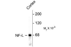 Western blots of rat cortex lysate showing specific immunolableing of the ~ 68k NF-L protein. (NEFL 抗体)