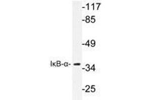 Western blot analyzes of IκB-α antibody in extracts from 293 cells. (NFKBIA 抗体)