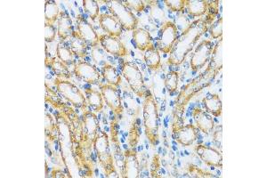 Immunohistochemistry of paraffin-embedded mouse kidney using  antibody (ABIN6129195, ABIN6137096, ABIN6137097 and ABIN6220538) at dilution of 1:100 (40x lens). (ARHGEF5 抗体  (AA 1248-1597))