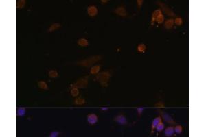 Immunofluorescence analysis of NIH/3T3 cells using NDUFA2 Polyclonal Antibody at dilution of 1:100. (NDUFA2 抗体)
