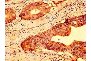 Immunohistochemistry (IHC) image for anti-ATP-Binding Cassette, Sub-Family G (WHITE), Member 5 (ABCG5) (AA 1-127) antibody (ABIN7144938)