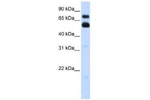 VISA antibody used at 1 ug/ml to detect target protein. (MAVS 抗体  (C-Term))