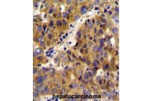 Immunohistochemistry (Paraffin-embedded Sections) (IHC (p)) image for anti-Branched Chain Keto Acid Dehydrogenase E1, beta Polypeptide (BCKDHB) (AA 44-74), (N-Term) antibody (ABIN950620)