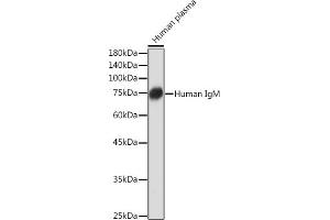 Western blot analysis of extracts of Human plasma, using Human IgM Rabbit mAb (ABIN7267845) at 1:1000 dilution. (IGHM 抗体)