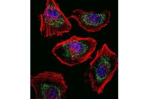 Fluorescent confocal image of Hela cell stained with SOX4 Antibody (N-term) (ABIN388786 and ABIN2839119). (SOX4 抗体  (N-Term))