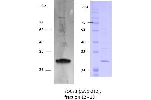Image no. 2 for Suppressor of Cytokine Signaling 1 (SOCS1) (AA 1-212) protein (His tag) (ABIN3147837)