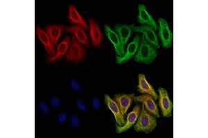 ABIN7094850 and ABIN7098901 staining Hela cells by IF/ICC. (CCT2 抗体  (C-Term))