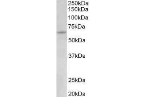 ABIN5539603 (0. (Uromodulin 抗体  (C-Term))