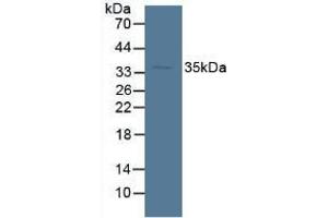 Detection of SDH in Mouse Liver Tissue using Polyclonal Antibody to Sorbitol Dehydrogenase (SDH) (SORD 抗体  (AA 98-355))
