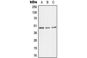 Western blot analysis of JNK3 expression in NIH3T3 (A), SKNSH (B), HeLa (C) whole cell lysates. (MAPK10 抗体  (C-Term))