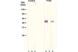 Treatment of A549 cells with the histone deacetylase inhibitor trichostatin A (TSA, 0. (alpha Tubulin 抗体  (acLys40))