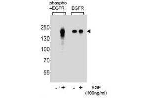 Western blot analysis of extracts from A431 cells, untreated or treated with EGF, using phospho-EGFR antibody (left) or nonphos Ab (right) (EGFR 抗体  (pTyr1172))