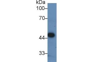 Detection of PDHA1 in Human ECV304 cell lysate using Polyclonal Antibody to Pyruvate dehydrogenase alpha 1 (PDHA1) (PDHA1 抗体  (AA 30-390))