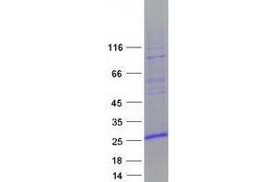 Western Blotting (WB) image for Zinc Finger, HIT-Type Containing 3 (ZNHIT3) protein (Myc-DYKDDDDK Tag) (ABIN2736144)