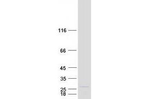 MRPL11 Protein (Transcript Variant 1) (Myc-DYKDDDDK Tag)