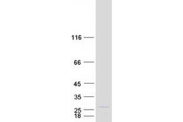 MRPL11 Protein (Transcript Variant 1) (Myc-DYKDDDDK Tag)