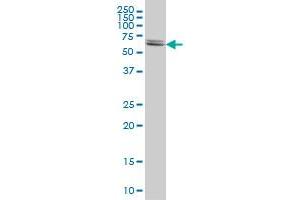 Western Blotting (WB) image for anti-Cystathionine-beta-Synthase (CBS) (AA 1-100) antibody (ABIN7489109)