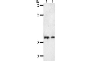 Western Blotting (WB) image for anti-Somatostatin Receptor 1 (SSTR1) antibody (ABIN2432309) (SSTR1 抗体)