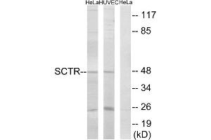 Western blot analysis of extracts from HeLa cells and HUVEC cells, using SCTR antibody. (SCTR 抗体  (Internal Region))