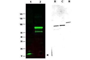 Western blot using  Protein A purified anti-SPANX-C antibody shows detection of a band at ~17 kDa corresponding to SPANX-C present in a nuclear extract from VWM105 cells (left panel, arrowhead). (SPANXC 抗体)