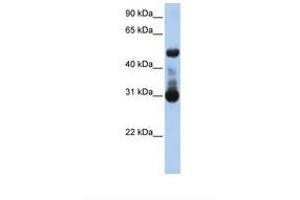 Image no. 1 for anti-Activin A Receptor Type II-Like 1 (ACVRL1) (AA 38-87) antibody (ABIN6738113) (ACVRL1 抗体  (AA 38-87))