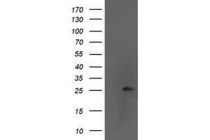 HEK293T cells were transfected with the pCMV6-ENTRY control (Left lane) or pCMV6-ENTRY AK4 (Right lane) cDNA for 48 hrs and lysed. (AK4 抗体)