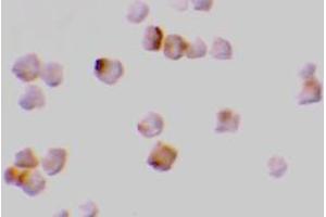 Immunocytochemistry of caspase-2 in A-20 cells with AP30196PU-N caspase-2 antibody at 2 μg/ml. (Caspase 2 抗体  (N-Term))
