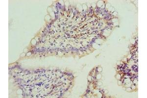Immunohistochemistry of paraffin-embedded human small intestine tissue using ABIN7152648 at dilution of 1:100 (FAR2 抗体  (AA 1-300))