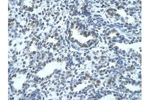 Rabbit Anti-IKZF4 Antibody Catalog Number: ARP33275  Paraffin Embedded Tissue: Human alveolar cell  Cellular Data: Epithelial cells of renal tubule Antibody Concentration:  4. (IKZF4 抗体  (N-Term))