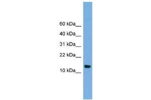 WB Suggested Anti-LSM8 Antibody Titration:  0. (NAA38 抗体  (N-Term))