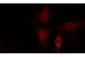 ABIN6275415 staining  HuvEc cells by IF/ICC. (SSH3 抗体  (Internal Region))