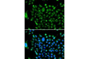 Immunofluorescence (IF) image for anti-Nuclear Receptor Co-Repressor 1 (NCOR1) (AA 1-200) antibody (ABIN6144420)