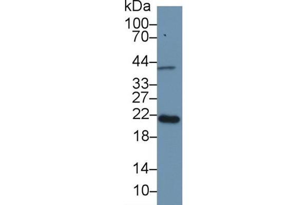 Apolipoprotein M 抗体  (AA 20-190)