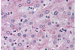 Immunohistochemistry (Formalin/PFA-fixed paraffin-embedded sections) of human liver tissue with GCGR polyclonal antibody . (Glucagon Receptor 抗体  (Extracellular Domain))