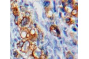 Used in DAB staining on fromalin fixed paraffin-embedded Ovary tissue (VTCN1 抗体  (AA 153-241))