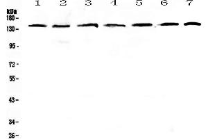 Western blot analysis of PERK using anti-PERK antibody .